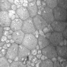 Microscopía especular del endotelio corneal
